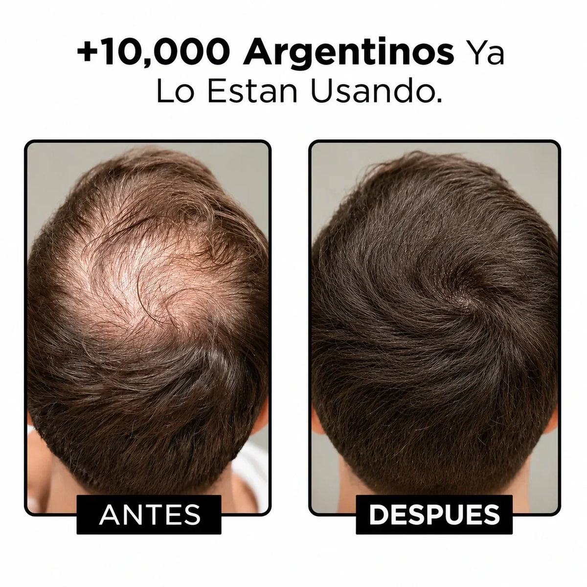 KIT ANTICAIDA | Recuperá tu Pelo: Frená la Caída y Estimulá el Crecimiento